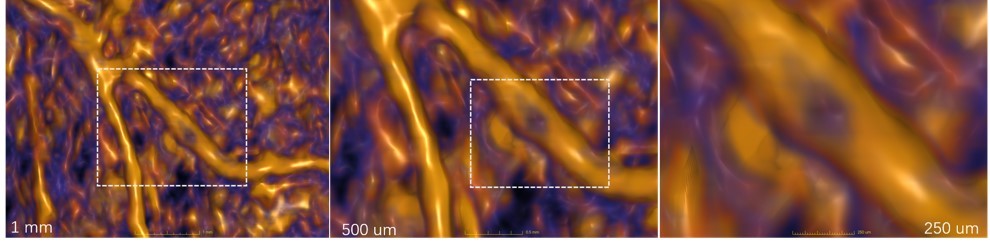 微观血管结构成像.jpg