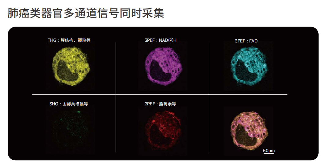 肺癌类器官多通道信号同时采集.png 肺癌类器官多通道信号同时采集.png