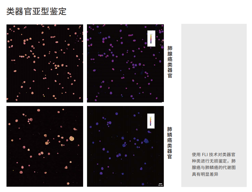 应用6-类器官亚型鉴定-1.png 应用6-类器官亚型鉴定-1.png